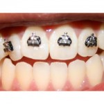 Ortodonta prywatny czy państwowy ?