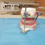 Protezy zębów: stałe czy ruchome?