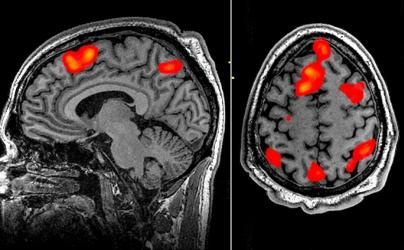 FMRI mózgu