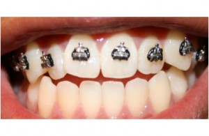 Ortodonta prywatny czy państwowy ?