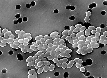 enterococcus